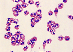 An image of human eosinophils isolated from the blood. 